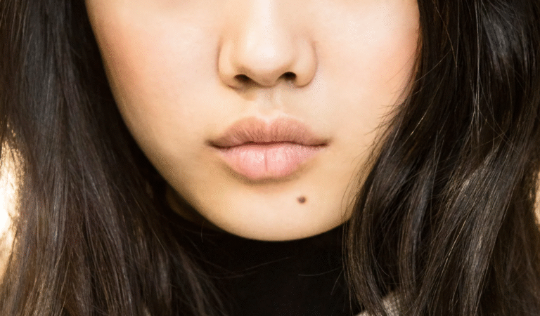 If You Have A Mole At One Of These 7 Places On Your Body This Is What It Means